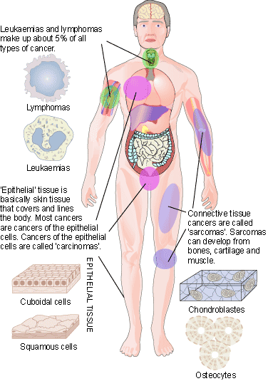 Different types of cancer are derived from different tissues within the body 