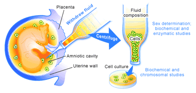 prenatalGD2.gif