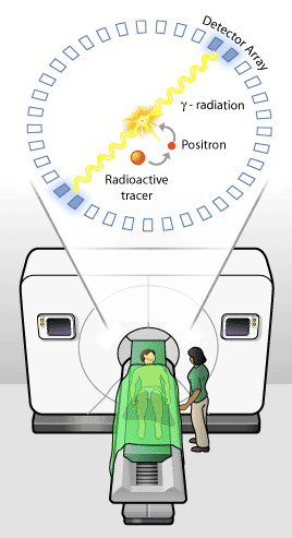 PET-schematic.gif