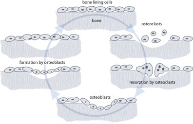 boneabsorption.jpg